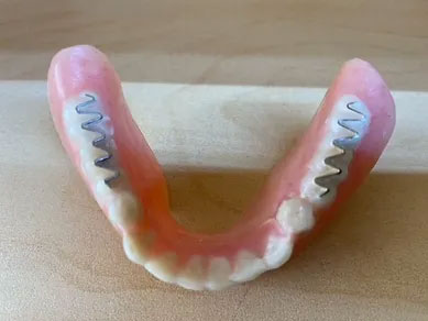 Specialty Dentures created at Dan's Denture Clinic