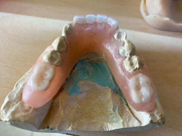 Duraflex Partial Dentures with Dan's Denture Clinic